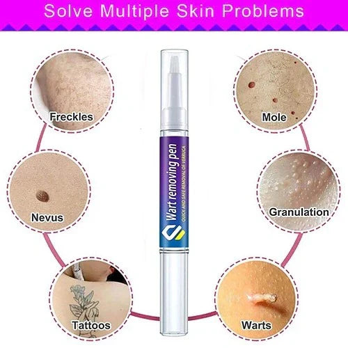 Warts & Moles Remover Pen