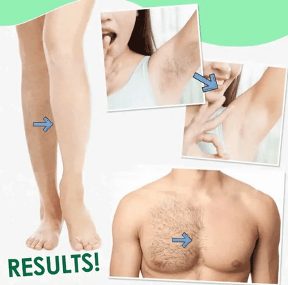 Sydonic Permanent Hair Removal Cream – For Face, Body, and Sensitive Areas | Dermatologist-Tested Solution